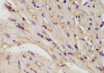 FYCO1 Rabbit Polyclonal Antibody