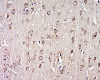 G protein alpha 16 Rabbit Polyclonal Antibody
