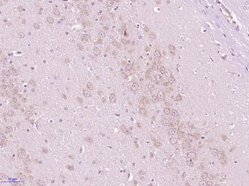 Phospho-GABRG2 (Ser366) Rabbit Polyclonal Antibody