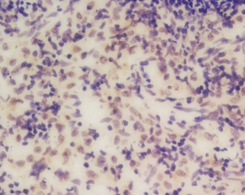 Galectin 10 Rabbit Polyclonal Antibody