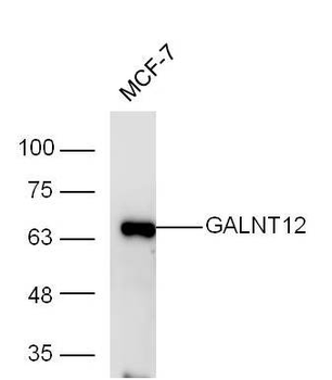GALNT12 Rabbit Polyclonal Antibody