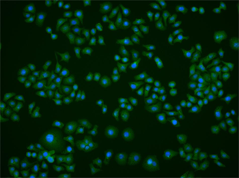 GAMT Rabbit Polyclonal Antibody