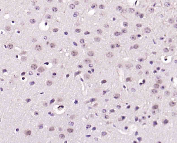 GAMT Rabbit Polyclonal Antibody