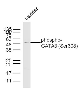 GATA3 (Phospho-Ser308) antibody