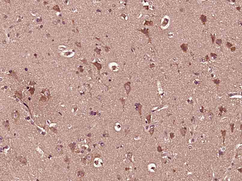 GBA Rabbit Polyclonal Antibody