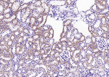 GBA3 Rabbit Polyclonal Antibody