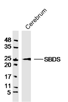 GCAP1 Rabbit Polyclonal Antibody