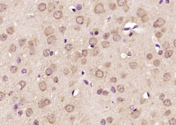 GCC1 Rabbit Polyclonal Antibody