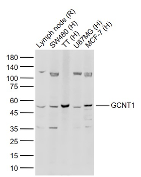 GCNT1 Rabbit Polyclonal Antibody