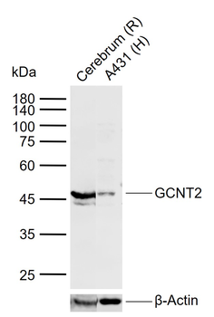GCNT2 Rabbit Polyclonal Antibody