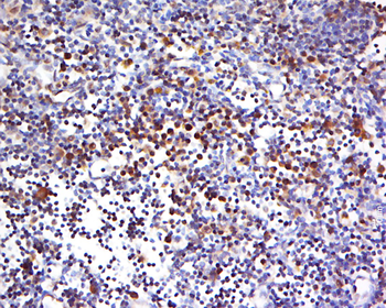 HECA Rabbit Polyclonal Antibody