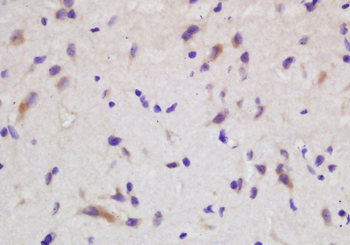 Gemin 7 Rabbit Polyclonal Antibody