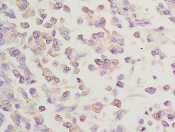 GGA2 Rabbit Polyclonal Antibody