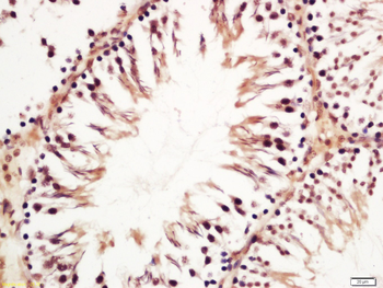 GGN Rabbit Polyclonal Antibody