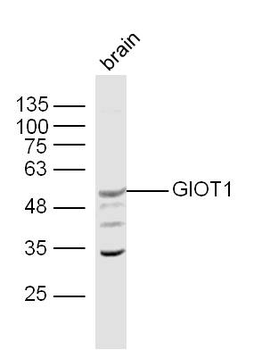 GIOT1 Rabbit Polyclonal Antibody