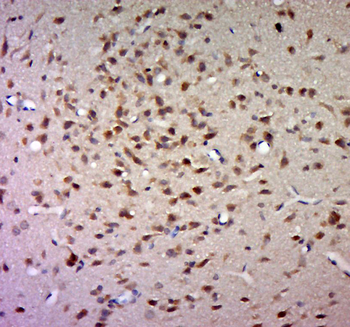 GLT1D1 Rabbit Polyclonal Antibody