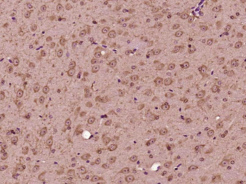 GLT25D2 Rabbit Polyclonal Antibody