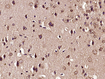 Phospho-GluR1 (Ser863) Rabbit Polyclonal Antibody