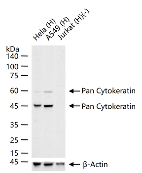 Pan Cytokeratin Mouse Monoclonal Antibody