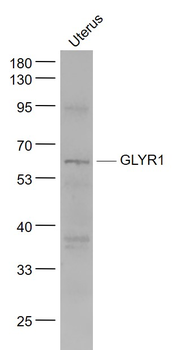 GLYR1 Rabbit Polyclonal Antibody