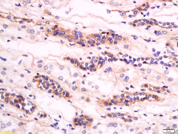 GM2A Rabbit Polyclonal Antibody