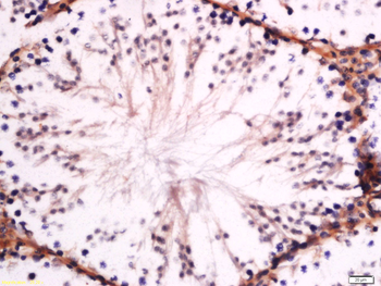 GM2A Rabbit Polyclonal Antibody