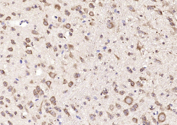 GMF beta Rabbit Polyclonal Antibody