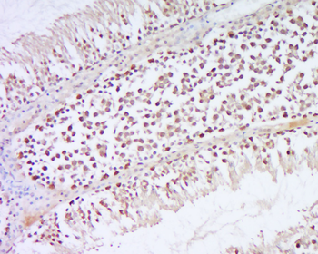 GNL2 Rabbit Polyclonal Antibody