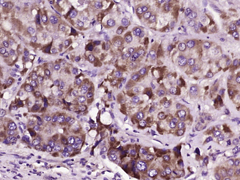 ZDHHC3 Rabbit Polyclonal Antibody