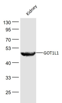 GOT1L1 Rabbit Polyclonal Antibody