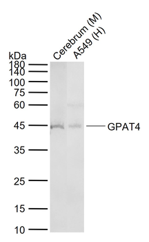 GPAT4 Rabbit Polyclonal Antibody