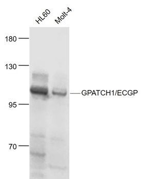 GPATCH1 antibody
