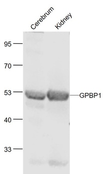 GPBP1 antibody