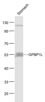 GPBP1L1 Rabbit Polyclonal Antibody