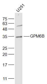 GPM6B Rabbit Polyclonal Antibody