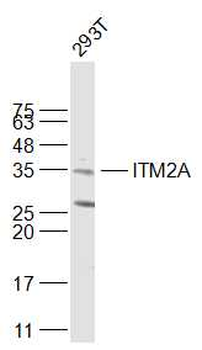 ITM2A Rabbit Polyclonal Antibody
