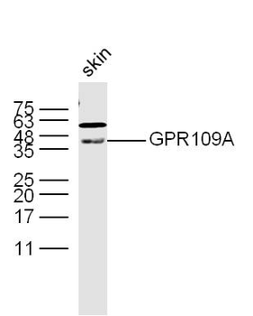 GPR109A Rabbit Polyclonal Antibody