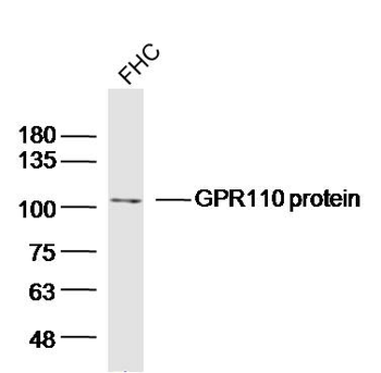 GPR110 Rabbit Polyclonal Antibody