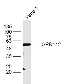 GPR142 Rabbit Polyclonal Antibody
