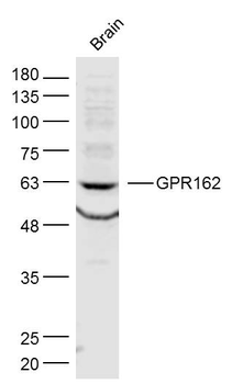 GPR162 Rabbit Polyclonal Antibody
