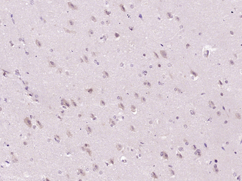 GPR18 Rabbit Polyclonal Antibody