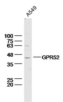 GPR52 Rabbit Polyclonal Antibody