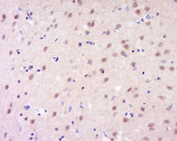 GSC Rabbit Polyclonal Antibody