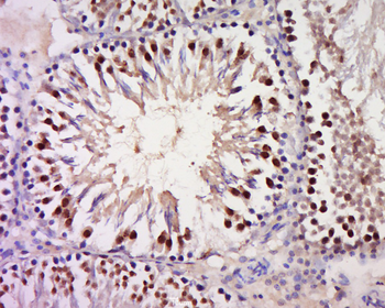 GSC Rabbit Polyclonal Antibody