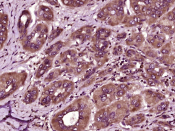 HAPLN1 Rabbit Polyclonal Antibody