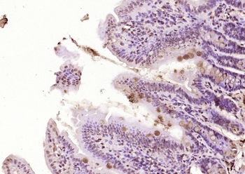 HBP1 Rabbit Polyclonal Antibody