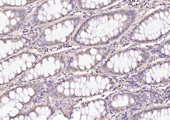 Phospho-HDAC5 (Ser259) Rabbit Polyclonal Antibody