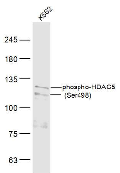 Phospho-HDAC5 (Ser498) Rabbit Polyclonal Antibody