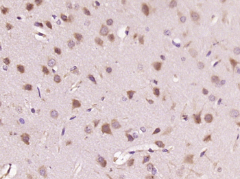 HDPTP Rabbit Polyclonal Antibody