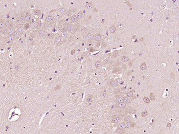HECT E3 ubiquitin ligase Rabbit Polyclonal Antibody
